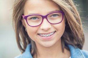 Kids & teens braces